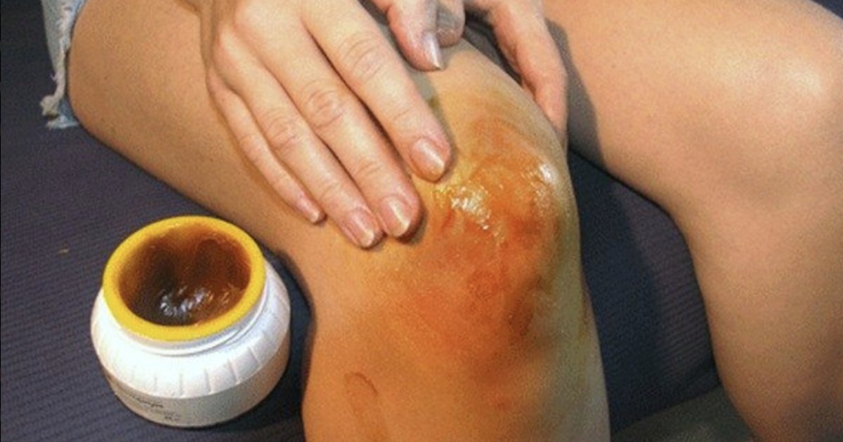 A topical balm being applied to a knee