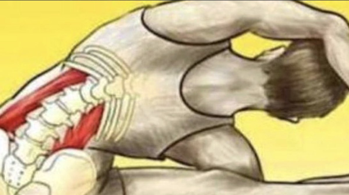 Illustration of the muscles around the lumbar spine