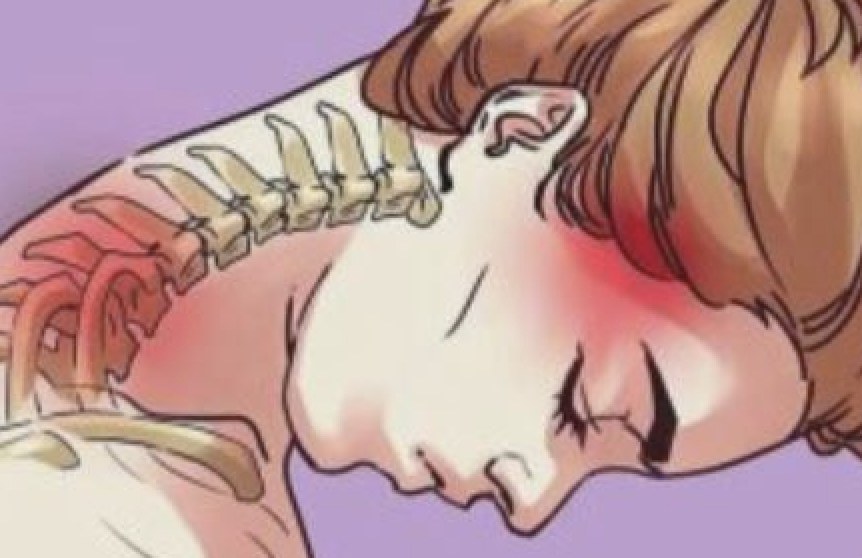 Illustration of neck stiffness