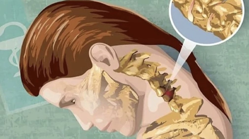 Illustration of the cervical spine